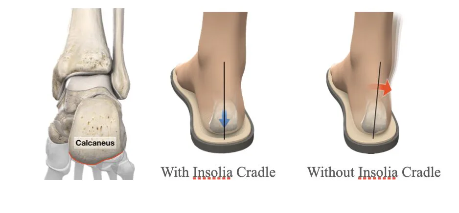 Insolia Is Challenging Decades of Athletic Footwear Design by Focusing on What Happens Inside the Shoe — additional view 3